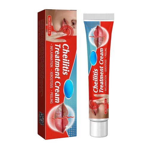 Dry Cracked Lips - Healing Lip Balm for Severely Chapped Lips - Designed for Men Women and Children Cheilitis Treatment Cream Natural & Organic Lip Cream All-Day Moisture Dermatologist Recommended