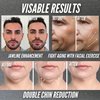 JawBlocks™ - Face Gym & Jaw Exerciser for Men & Woman [3 levels 6pcs kit] powerful jawline shaper | double chin eliminator | jawline exerciser| double chin reducer| face lift device & Jaw trainer