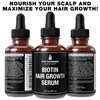 Biotin Hair Growth Serum For Hair Thickening + Moisturizing. Vegan Hair Growth Oil Scalp Treatment For Women, Men with Dry, Frizzy, Weak Hair and Hair Loss. With Ginger + Rosemary. Unscented 2oz