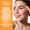 Retinol + Vitamin C Eye Cream - Anti-Aging, Dark Circle & Puffiness Treatment for Smooth, Firm Skin - Hydrating & Nourishing Formula for Sensitive Under-Eye Area