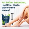 Foot Cure Foot Care/ Exfoliator & Callus Remover Pedicure Set – Includes Foot File for Dead Skin, Tea Tree Oil Foot Soak Salts, Urea Cream 40 Percent & Foot Callus Removal Gel – Made in USA