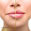 DERMOCURA Chili Lip Plumper Glossy Balm 5X More Powerful Transparent Glossy Lip Plumping Lip Gloss