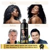 Solutrel Black Hair Dye Shampoo, Complete Gray Coverage, 10-in-1 Unisex Hair Color Shampoo With Natural Ingredients, No Skin Stain - Ammonia Free.