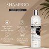 Alopecia Areata Treatment Hair Loss Shampoo - Amazing Hair Growth Product Helps with Thinning Hair, Alopecia Treatment & Receding Hairlines - 12 fl oz