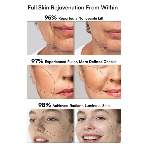 INIA 3-in-1 Skin Tightening Device True Beauty Glow Facial Massager Red Light Therapy for Face and Neck