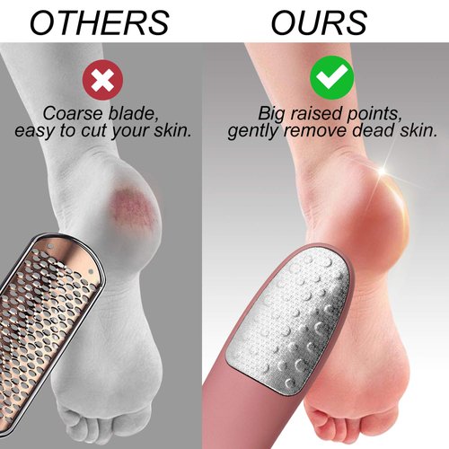 Foot Scrubber with Stand, Never-Cut-Your-Feet Foot File Callus Remover - Safe to Use | Comfortable Foot Scraper Feet Scrubber Dead Skin Remover, Best Home Pedicure Foot Care Tool, Used on Wet/Dry Feet