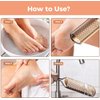 Foot File Foot Scrubber Pedicure - Callus Remover for Feet Easkep Professional Grater Rasp Foot Scraper Corns Callous Removers Cracked Dead Skin Remover for Dry and Wet Feet (Golden)