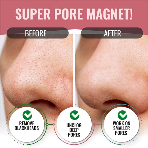 LOOKATME Nose Pore Strips (4-Pack, 20 Nose Strips). Korean Skin Care Blackhead Remover. K Beauty Blackhead Strips for Nose and Face, Black Head Strips Women. Acne Mask for Blackhead Removal. (Combo)