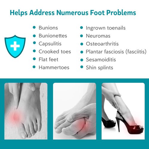 KIYOKI Toe Spacers Toe Separators for Women Men to Correct Bunion, Bunion Corrector, Hammer Toe Straighteners, Relief Restore Feet