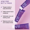 Seroflora Butt & Thighs Acne Treatment Cream - Butt Acne Clearing Cream for Pimples, Zits, Razor Bumps, Dark Spots - Acne Clearing Lotion for Buttocks & Body - Inner Thigh Blackhead Remover (4oz)
