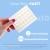 Acne Patches for Face - Hydrocolloid Bandages (360 Count) Pimple Patches for Face in 2 Universal Sizes, Acne Spot Treatment Care for Face & Skin Spot Patch Conceals Zits, Acne and Blackheads