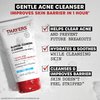 THAYERS Blemish Clearing Face Cleanser with 1.5% Salicylic Acid, Acne Treatment Face Wash, Soothing and Non-Stripping Skin Care, 4.4 Fl Oz