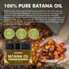 Batana Oil for Hair Growth Organics 100% Natural Pure Batana Hair Oil Batana Oil Nourishes Damaged Hair raw Batana Butter Prevent Hair Loss Natural Hair Growth Oil and Conditioner