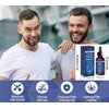 Hair Growth Serum, 5% Minoxidil, With Biotin & Glycerin, for Men's Beard & Women's Hair Regrowth, Anti Hair Loss Treatment, Make Hair Stronger Thicker Longer, 1 fl oz (30 ml)