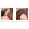 Caboki Healthful Powder Volumizer for Men & Women: Thinning Hair Solution for Root Touch Up, Hairline & Edges, Covering Hair Loss, Bald Spots & Gray Hair - TALC-Free,