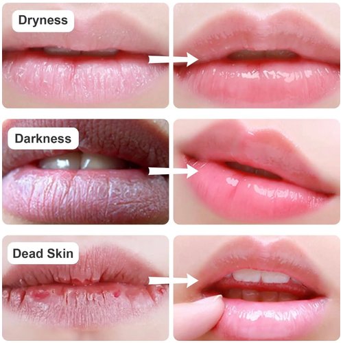 New Lip and Eye Mask 2 Sets, Hydro-Gel Eye Mask For Puffiness, Lip Collagen Plumper, Eye Mask Skincare, Rich Goat Milk (white/white)