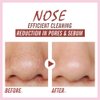 Blackhead Remover Nose Pore Strips - Deep Cleansing and Moisture Clear-Up Strips for Blackheads, for Women & Men (20 PCS)