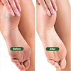 TADA Natural Beauty Foot File Callus Remover - Multi Purpose 2 in 1 Feet Pedicure Tools with Foot Scrubber, Pumice Stone
