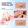 ANGTICS Pimple Patches for Face, 2 Sizes 192 Counts Acne Patches, Hydrocolloid Patches Zit Patches for Skin Care, Blemish Patches Invisible Acne Spot Treatment with Salicylic Acid, Tea Tree Oil