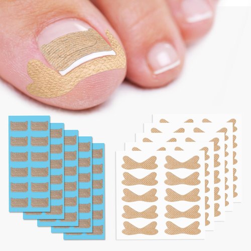 BEZOX 60Pcs Breathable Ingrown Toenail Corrector Patches and 50Pcs Ingrown Toenail Stickers - Pro...