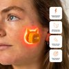 Faeves By Céleste Clarifying LED Patch, Light Therapy Acne Patch, Pimple Patch, Red & Blue Light, Cute Cat Shape