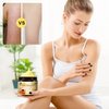 2pcs Bee Venom Treatment Cream, New Professional Bee Venom Repair Cream, Bee Venom Cream for All Body Parts