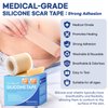 Aroamas Scar Silicone Scar Sheets – Silicone Scar Tape – 1.6"x60" for Softening and Flattening Scars, C-Section, Keloid, Surgery – Reusable & Washable – Painless Removal – 3-4 Month Supply