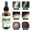 Kisskin's Organic Rosemary Mint Scalp & Hair Strengthening Oil With Castor Oil,Olive Oil,Coconut,Eucalyptus,Ginger Root,Tea Tree Leaf, Infused With Biotin For Daily Use. 2oz