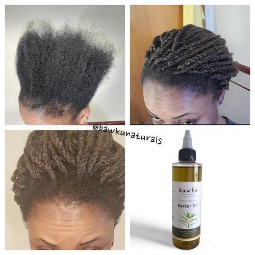 bawku naturals Karkar Hair Oil - Traditional Hair Strengthener, Repair and Moisturizer for Maximum Growth From Chad (Blend With Chebe Powder) 4 oz