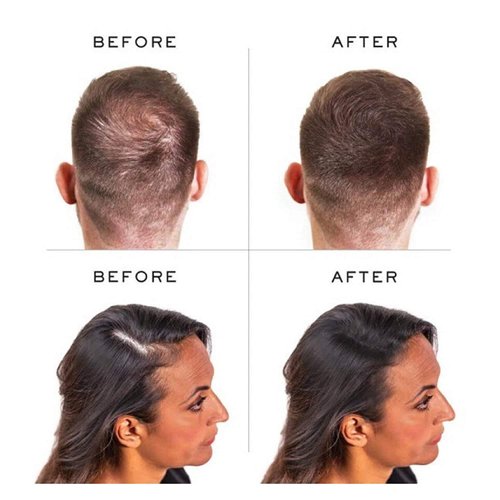 PROCOVR The ORIGINAL Thinning Hair and Hairline Concealer, Natural Hair Mascara for Balding Areas, Root Touch-Up for Thicker Appearance (Natural Brown FBA)