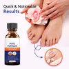 Toenail Fungus Treatment, Nail Fungus Treatment for Toenail, Toe Nail Fungus Treatment Extra Strength, Fungus Nail Treatment, Nail Fungus Treatment for Nail, Fungus Treatment for Fingernails