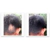 Caboki 10X Volumizing Hair Powder for Thinning Hair: Root Touch Up, Fill in Hairline & Edges, Cover Bald Spots and Gray For Men and Women. TALC-Free,Dark Brown