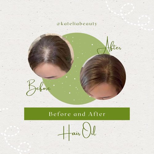 4-in-1 Katelia Beauty Multi-Purpose Hair Treatment: Nourishing Oil for Scalp, Hair, Brow & Beard - Promotes Growth, Strength & Vitality, Anti-Hair Loss, 30 ml