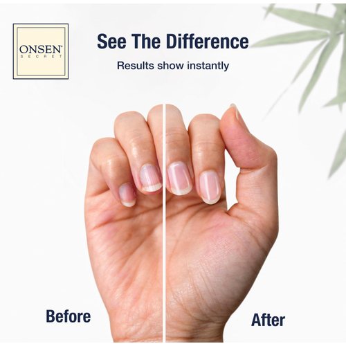 Onsen Cuticle Cream w/Nail Cuticle Oil | Cuticle Softener with Japanese Natural Healing Minerals | Nail Care Serum to Soothe, Repair & Strengthen Cuticles and Nails | Visible Results (1 Count/15 ml)