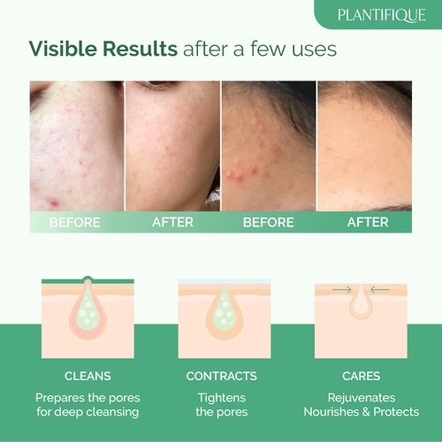 PLANTIFIQUE Korean Skin Care Detox Face Mask with Avocado & Superfoods - Hydrating Clay Mud Mask Dermatologist Tested for Face and Body - Vegan Skincare 3.4 Oz/100ml