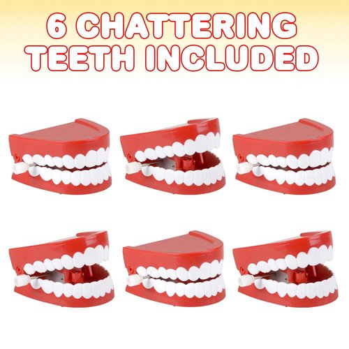 ArtCreativity Chattering Teeth Wind Up Toy, Set of 6, Windup Chomping Toy Mouth, Dental Tooth Party Decorations, Fun Birthday Party Favors for Kids, Dentist Office Toys, Joke Gag Gift