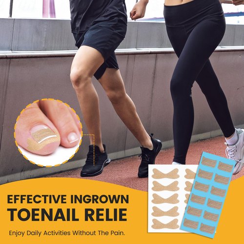 BEZOX 60Pcs Breathable Ingrown Toenail Corrector Patches and 50Pcs Ingrown Toenail Stickers - Professional Ingrown Toe Nail Treatment Tape for Pain Relief and Correction