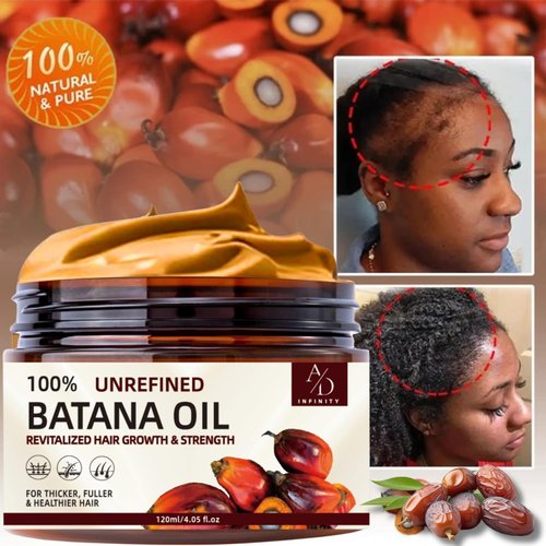 100% Unrefined Raw Batana Oil for Hair Growth Dr. Sebi Organic Pure from Honduras with Keratin, Coffee Extract & Other Ingredients to Enhance Efficacy for Thicker, Strength (Botana Oil)