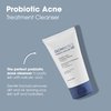 Glowbiotics Probiotic Acne Treatment Cleanser: Foaming Face Wash, Salicylic Acid Acne Control, Oily Skin Solution with Ceramides & Niacinamide, 5 Fl Oz