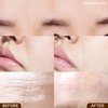 Marshique Wrinkle Repair Patches for Frown Lines Eleven Lines - Between the Eyes Wrinkle Patches Non invasive Wrinkle Smoothers for Face Wrinkles - Face Wrinkle Pad- Korea Beauty Face Treatment