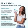 MDacne 3 Step Retinol Acne Kit - Retinol Cream 0.25%, Salicylic Acid Cleanser, Niacinamide Moisturizer - Plant-Based products for Hormonal Acne, Blemishes, and Wrinkles. 30 Day Complete Acne Care Kit
