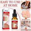 2PCS Ingrown toenail drops,Ingrown Toenail Relief,Easy Trim Ingrown Toenail Tools,Toenail Fluid With Silicone Gel Toe Caps Essential Oil Diffuser,Ingrown Toenail Reliever and Softener Kit