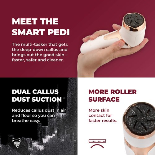 Own Harmony Electric Callus Remover with Vacuum - Foot Care for Women - Professional Pedicure Tools for Powerful Pedi Care Vac - 3 Rollers Electric Feet File CR2100 - Best for Hard Dry, Cracked Heels