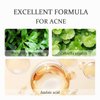 20% Azelaic Acid Cream for Face,Azelaic Acid Moisturize With Hyaluronic Acids for Face Redness, Pimple CreamAnti Acne Breakouts Azelaic Acid Gel Balance Excess Oil & Soothing No Irritation