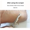AKOAK 5 Pcs Stainless Steel Scraper Multifunctional Professional Pedicure Tools to Remove Dead Skin Callus Knife Scraping Pedicure Tools