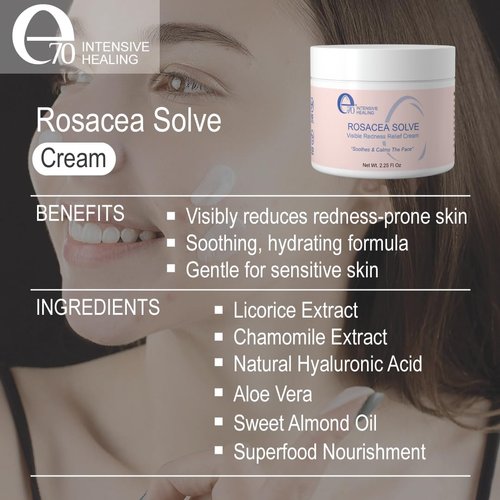 e70 Rosacea Solve - Redness Relief Cream - Face Moisturizer For Rosacea & Acne Prone Skin - Sensitive Skin Care With Organic Ingredients, Almond Oil, Licorice & Chamomile Extracts - No Parabens
