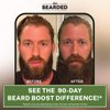 Live Bearded: Beard Boost - Beard Hair Growth Multivitamins with Biotin 10,000mcg, Vitamin C, Vitamin E and Zinc - 90-Day Supply - Thick, Strong, Full Beard Growth Support - Made in The USA