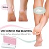 ZMOI Glass Pumice Stone Callus Remover for Feet, Elbows, Hands, and Knees, Spain Made - 2 in 1 Pedicure Exfoliator and Scrubber for Rough, Hard Skin (Pink Color)