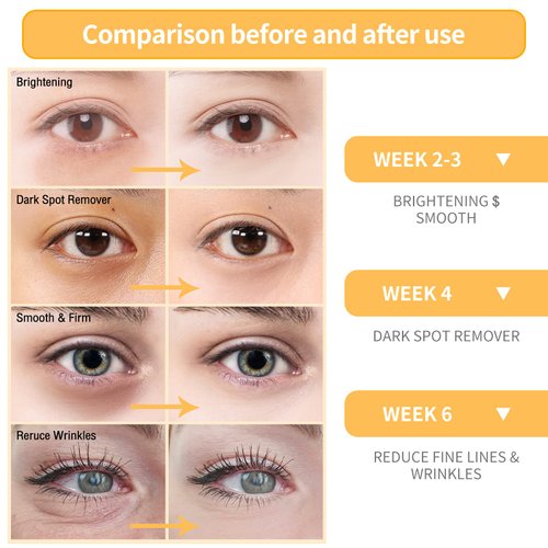 BREYLEE Vitamin C Serum for Face & Eye (o.6 oz) for Brightening Skin,Dark Spot Remover,Reduce Wrinkle,Anti Aging Serum,Moisturizer Brightening Serum with Hyaluronic Acid,Vitamin E,Retinol, Niacinamide