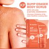 KP Bump Eraser Body Scrub, Bump Eraser Body Scrub, Keratosis Pilaris Treatment, Strawberry Legs Treatment For Women, Kp Bump Eraser, Kp Body Scrub, Exfoliating Body Scrub for Women & Men Exfoliation